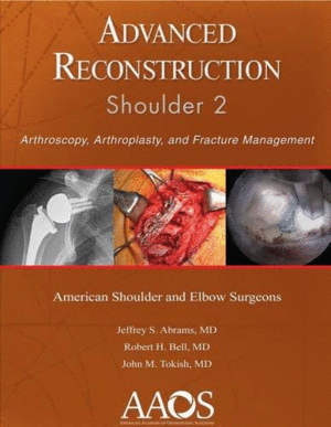 ADVANCED RECONSTRUCTION. SHOULDER 2. ARTHROSCOPY, ARTHROPLASTY AND FRACTURE MANAGEMENT. 2ND EDITION