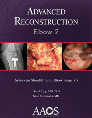ADVANCED RECONSTRUCTION: ELBOW 2. + 9 SURGICAL VIDEOS