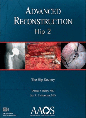 ADVANCED RECONSTRUCTION: HIP 2 + VIDEOS ONLINE. 2ND EDITION
