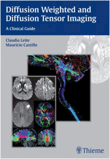 DIFFUSION WEIGHTED AND DIFFUSION TENSOR IMAGING. A CLINICAL GUIDE