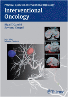 INTERVENTIONAL ONCOLOGY