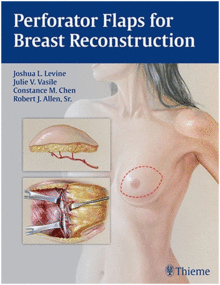 PERFORATOR FLAPS FOR BREAST RECONSTRUCTION.