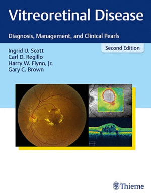 VITREORETINAL DISEASE. DIAGNOSIS, MANAGEMENT, AND CLINICAL PEARLS. 2ND EDITION