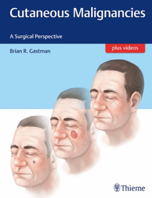 CUTANEOUS MALIGNANCIES. A SURGICAL PERSPECTIVE