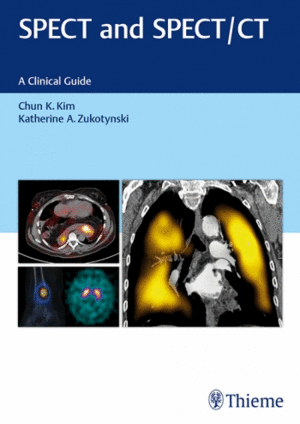 SPECT AND SPECT/CT. A CLINICAL GUIDE