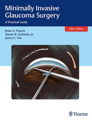 MINIMALLY INVASIVE GLAUCOMA SURGERY. A PRACTICAL GUIDE