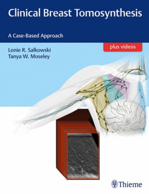 CLINICAL BREAST TOMOSYNTHESIS. A CASE-BASED APPROACH + VIDEOS ONLINE