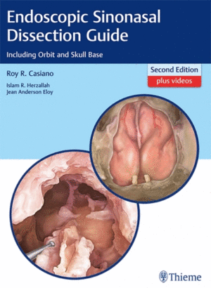 ENDOSCOPIC SINONASAL DISSECTION GUIDE INCLUDING ORBIT AND SKULL BASE + VIDEOS. 2ND EDITION