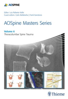 AOSPINE MASTERS SERIES, VOL. 6: THORACOLUMBAR SPINE TRAUMA