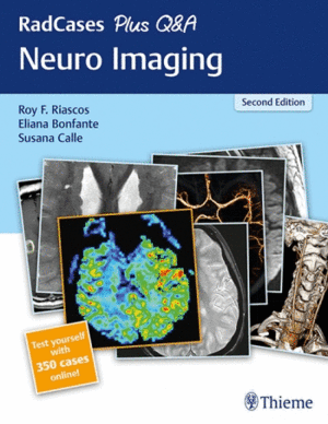 RADCASES PLUS Q&A: NEURO IMAGING + 350 CASES ONLINE. 2ND EDITION