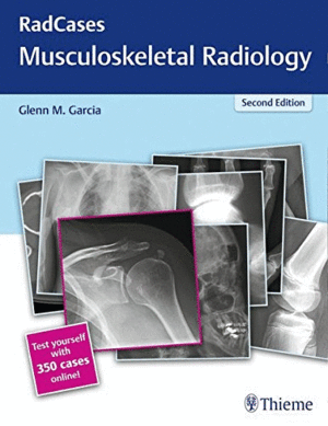 RADCASES MUSCULOSKELETAL RADIOLOGY + 350 CASES ONLINE. 2ND EDITION