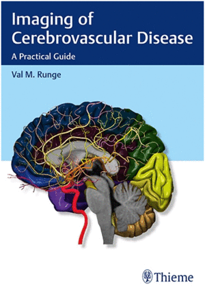 IMAGING OF CEREBROVASCULAR DISEASE. A PRACTICAL GUIDE
