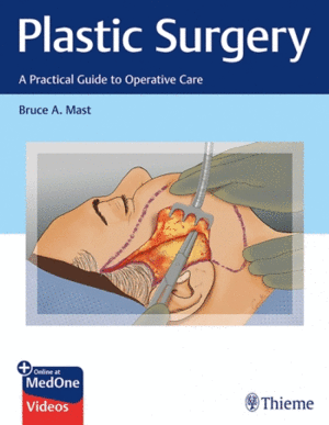 PLASTIC SURGERY. A PRACTICAL GUIDE TO OPERATIVE CARE + ONLINE AT MEDONE