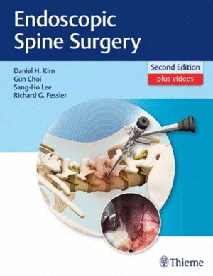 ENDOSCOPIC SPINE SURGERY + VIDEOS ONLINE. 2ND EDITION