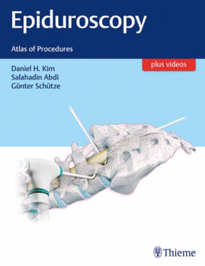 EPIDUROSCOPY. ATLAS OF PROCEDURES  PLUS VIDEOS