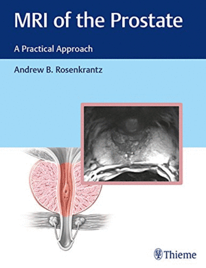 MRI OF THE PROSTATE: A PRACTICAL APPROACH
