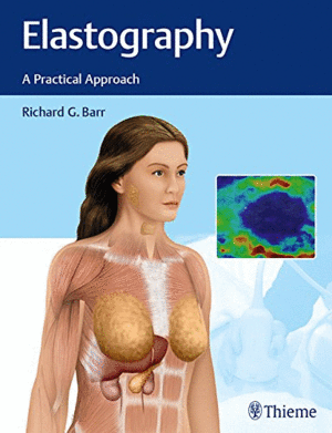 ELASTOGRAPHY: A PRACTICAL APPROACH