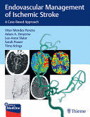ENDOVASCULAR MANAGEMENT OF ISCHEMIC STROKE. A CASE-BASED APPROACH