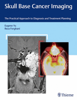 SKULL BASE CANCER IMAGING. THE PRACTICAL APPROACH TO DIAGNOSIS AND TREATMENT PLANNING