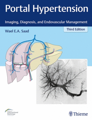 PORTAL HYPERTENSION. IMAGING, DIAGNOSIS, AND ENDOVASCULAR MANAGEMENT. 3RD EDITION