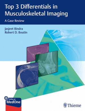TOP 3 DIFFERENTIALS IN MUSCULOSKELETAL IMAGING. A CASE REVIEW