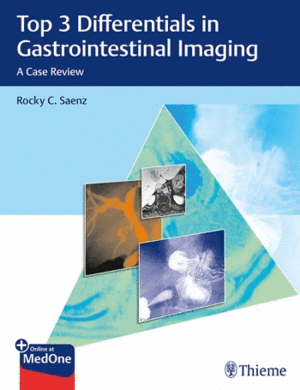 TOP 3 DIFFERENTIALS IN GASTROINTESTINAL IMAGING. A CASE REVIEW + ONLINE AT MEDONE