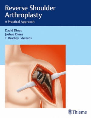 REVERSE SHOULDER ARTHROPLASTY