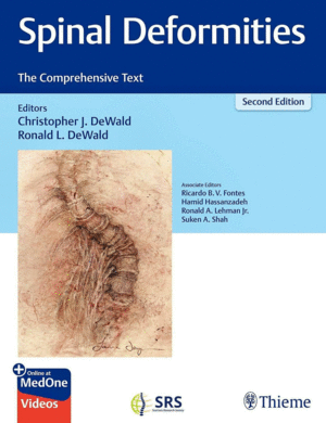 SPINAL DEFORMITIES. THE COMPREHENSIVE TEXT. 2ND EDITION