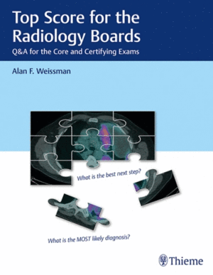 TOP SCORE FOR THE RADIOLOGY BOARDS. Q&A REVIEW FOR THE CORE AND CERTIFYING EXAMS