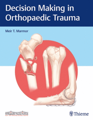 DECISION MAKING IN ORTHOPAEDIC TRAUMA