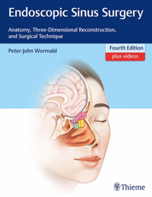ENDOSCOPIC SINUS SURGERY. ANATOMY, THREE-DIMENSIONAL RECONSTRUCTION, AND SURGICAL TECHNIQUE. 4TH EDITION