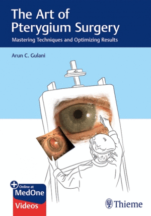 THE ART OF PTERYGIUM SURGERY. MASTERING TECHNIQUES AND OPTIMIZING RESULTS + ONLINE AT MEDONE