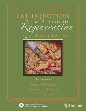 FAT INJECTION. FROM FILLING TO REGENERATION. 2ND EDITION