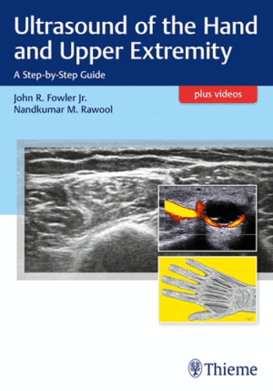 ULTRASOUND OF THE HAND AND UPPER EXTREMITY. A STEP-BY-STEP GUIDE