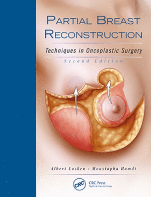 PARTIAL BREAST RECONSTRUCTION. TECHNIQUES IN ONCOPLASTIC SURGERY + DVD. 2ND EDITION