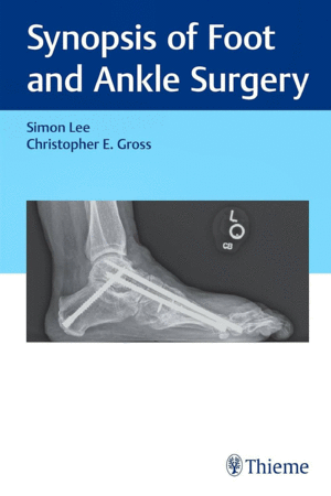 SYNOPSIS OF FOOT AND ANKLE SURGERY
