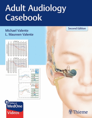 ADULT AUDIOLOGY CASEBOOK + ONLINE AT MEDONE. 2ND EDITION