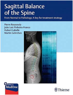 SAGITTAL BALANCE OF THE SPINE. FROM NORMAL TO PATHOLOGY: A KEY FOR TREATMENT STRATEGY