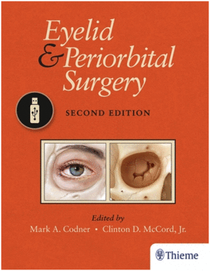 EYELID AND PERIORBITAL SURGERY (USB FLASH DRIVE). 2ND EDITION