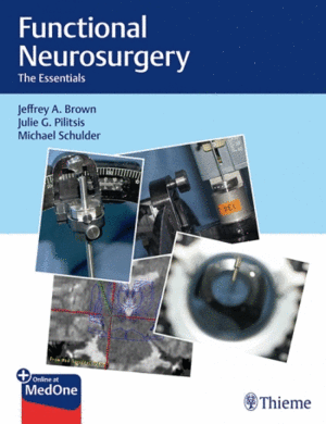 FUNCTIONAL NEUROSURGERY. THE ESSENTIALS + ONLINE AT MEDONE