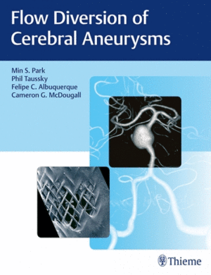 FLOW DIVERSION OF CEREBRAL ANEURYSMS