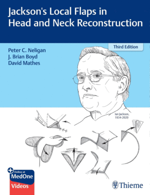 JACKSON'S LOCAL FLAPS IN HEAD AND NECK RECONSTRUCTION. 3RD EDITION