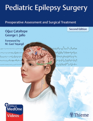 PEDIATRIC EPILEPSY SURGERY. PREOPERATIVE ASSESSMENT AND SURGICAL TREATMENT + ONLINE AT MEDONE. 2ND E