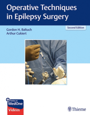 OPERATIVE TECHNIQUES IN EPILEPSY SURGERY + ONLINE AT MEDONE. 2ND EDITION