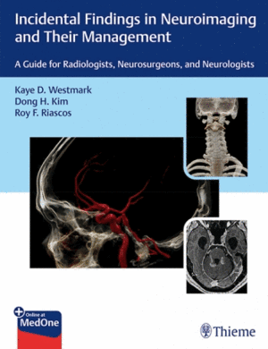 INCIDENTAL FINDINGS IN NEUROIMAGING AND THEIR MANAGEMENT. A GUIDE FOR RADIOLOGISTS, NEUROSURGEONS, A