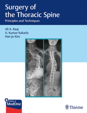SURGERY OF THE THORACIC SPINE. PRINCIPLES AND TECHNIQUES
