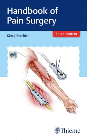 HANDBOOK OF PAIN SURGERY