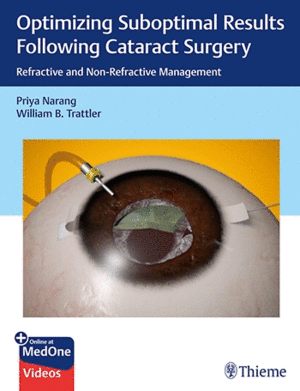 OPTIMIZING SUBOPTIMAL RESULTS FOLLOWING CATARACT SURGERY. REFRACTIVE AND NON-REFRACTIVE MANAGEMENT +