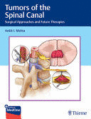 TUMORS OF THE SPINAL CANAL. SURGICAL APPROACHES AND FUTURE THERAPIES