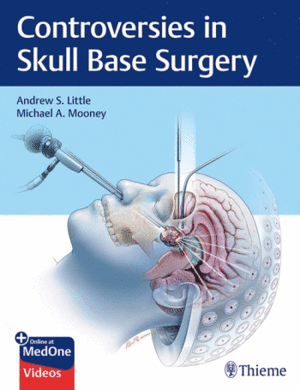 CONTROVERSIES IN SKULL BASE SURGERY + ONLINE AND MEDONE VIDEOS